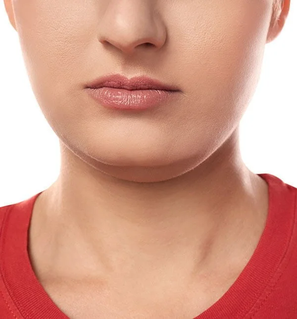 Get a Chiseled Face With Facial Liposuction