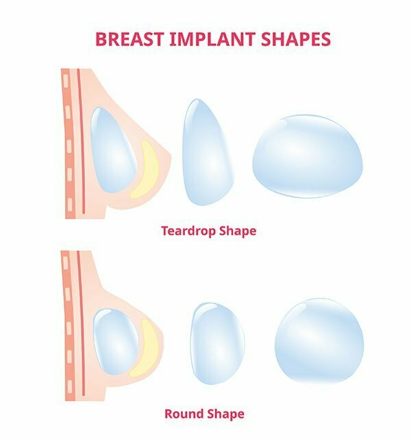 Breast Implant Shapes And Sizes Boutinic Aesthetics   Breast Implants Shapes 