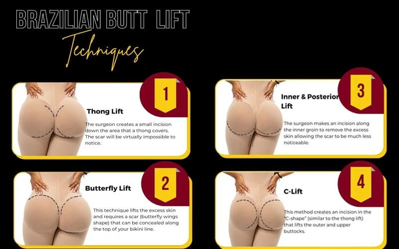 Brazilian Butt Lift Miami - $3,800 BBL