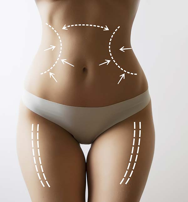 Smart Lipo Miami - Smart liposuction