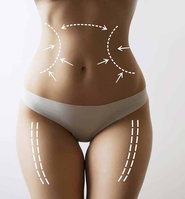 https://boutinicaesthetics.com/wp-content/uploads/2023/01/smart-lipo-miami-1.jpg