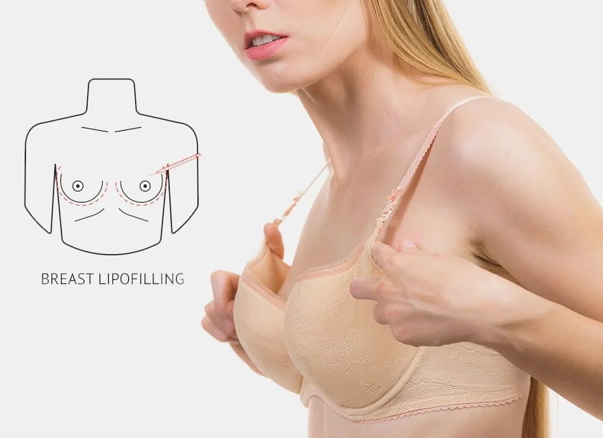 Breast Fat Grafting