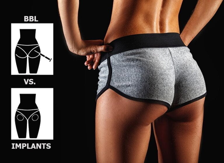 Butt Implants vs BBL Key Differences Boutinic Aesthetics