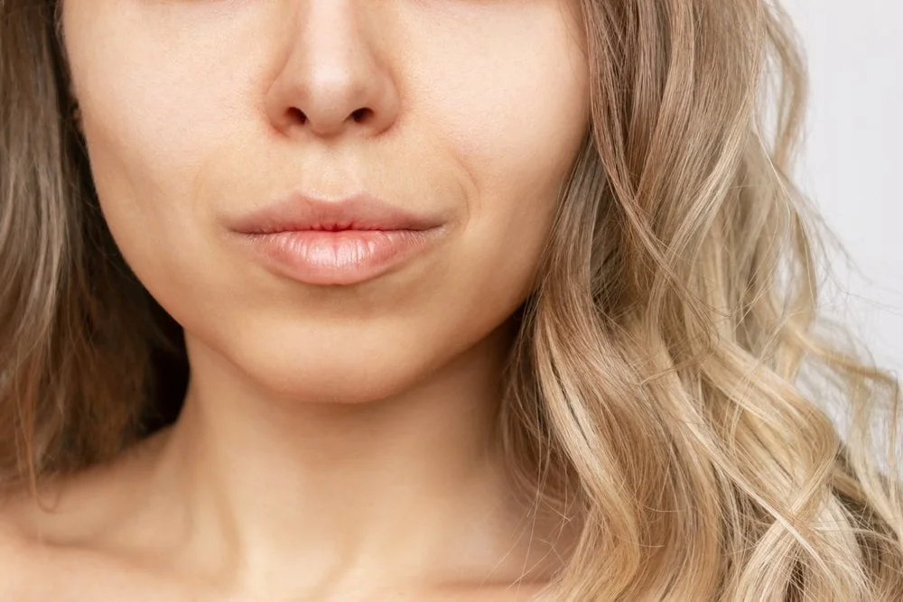 Buccal fat removal cost houston
