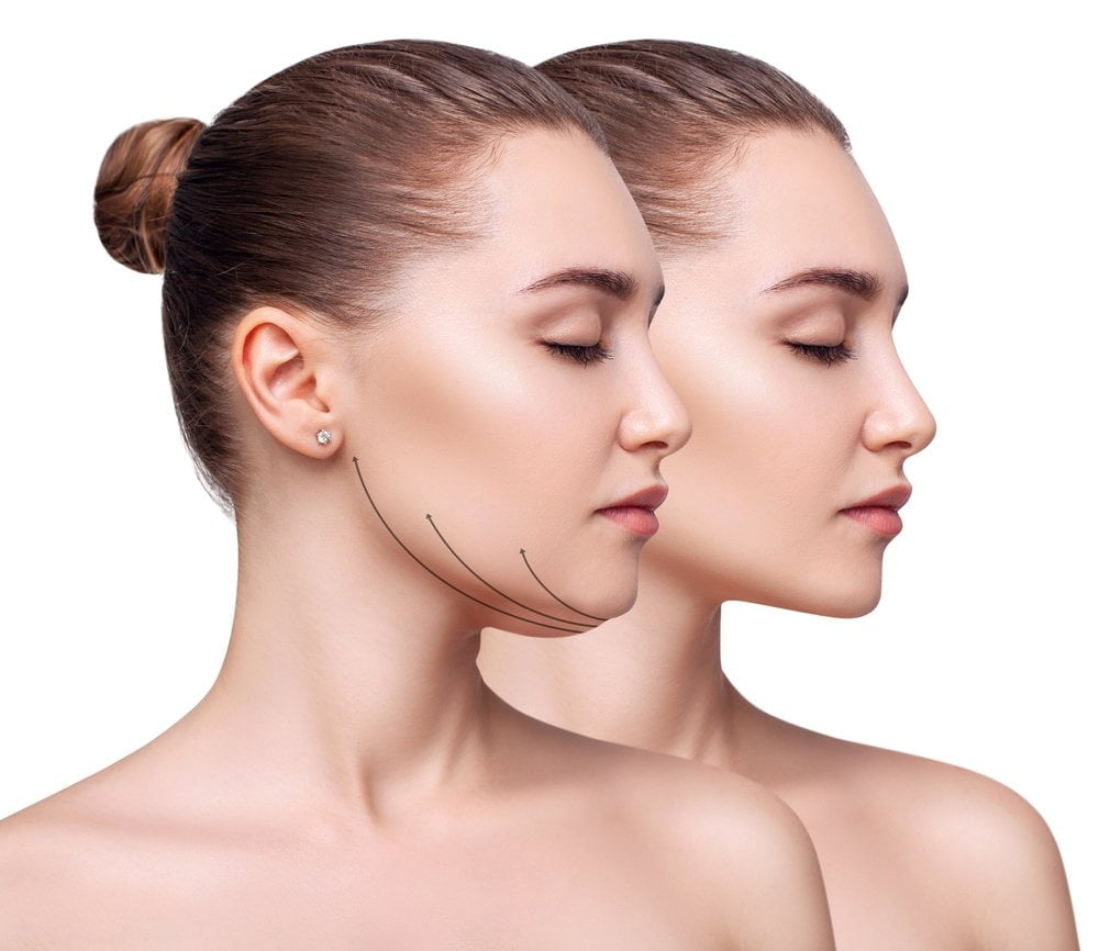 Factors Influencing Buccal Fat Removal and Chin Liposuction Costs