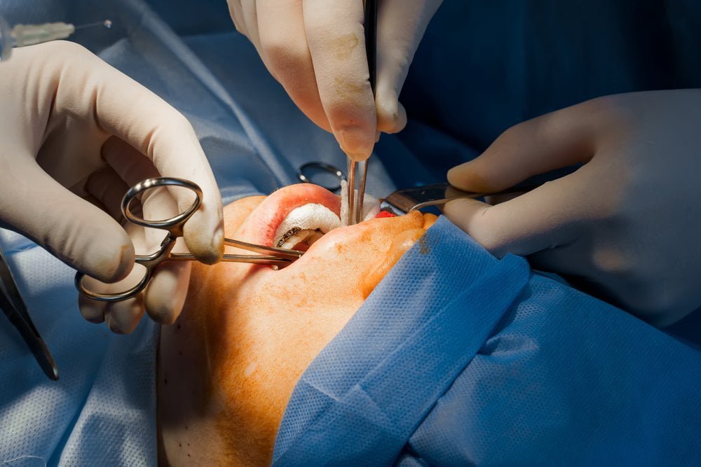 Influence of Surgeon's Expertise and Reputation