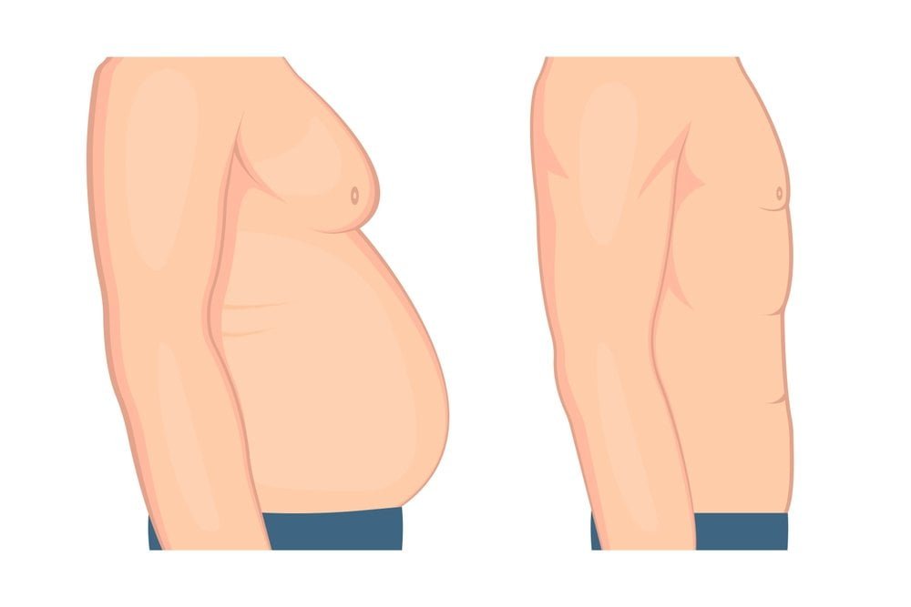 Post-Surgery Symptoms to Expect