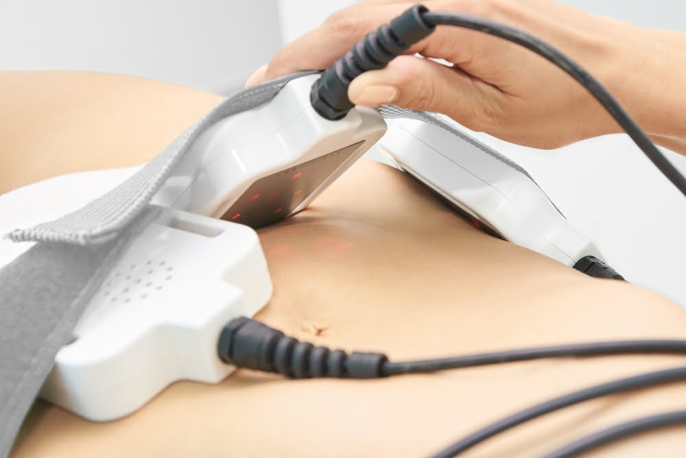 Treatment Versatility Areas Addressed by VASERlipo and Laser Lipo